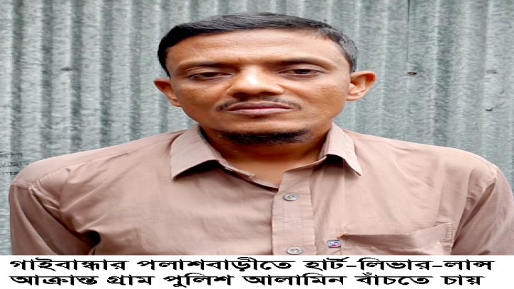 পলাশবাড়ীতে হার্ট-লিভার-লান্স আক্রান্ত গ্রাম পুলিশ আলামিন বাঁচতে চায়  