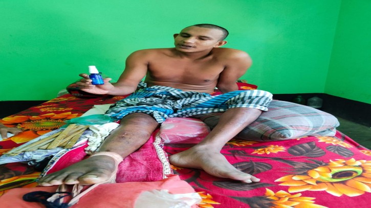 পিরোজপুরের ট্রাক চালক বাগেরহাটে হাড় ভাঙ্গার অপ-চিকিৎসায় পঙ্গুপ্রায়