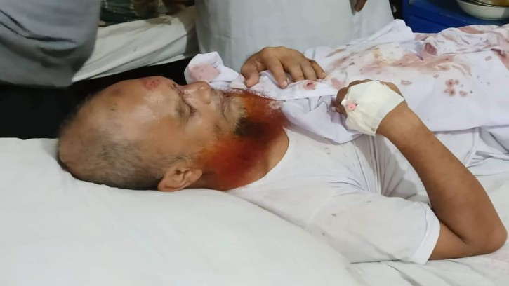 পিরোজপুরে মাদ্রাসার ভেতরে ঢুকে সহ সুপারকে আহত করেছে প্রতিপক্ষ