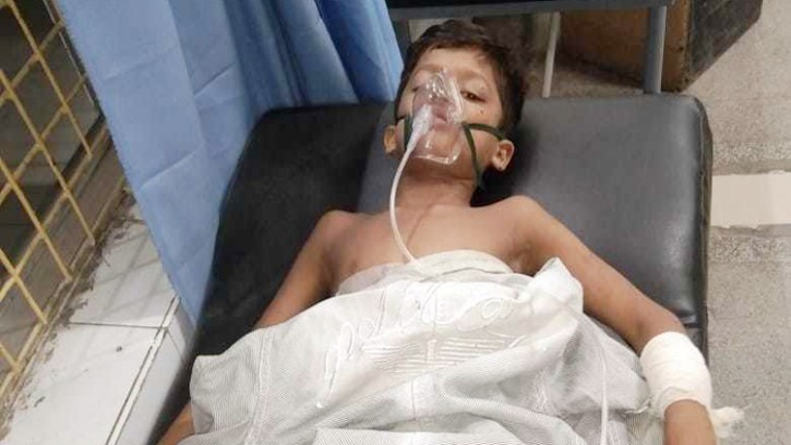 শিবগঞ্জে ককটেল বিস্ফোরণে শিশু আহত