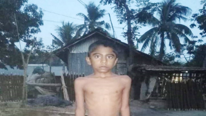 বাঁচতে চায় ৯ বছরের শিশু আজাদ বিশ্বাস : প্রয়োজন ৩ লাখ টাকা