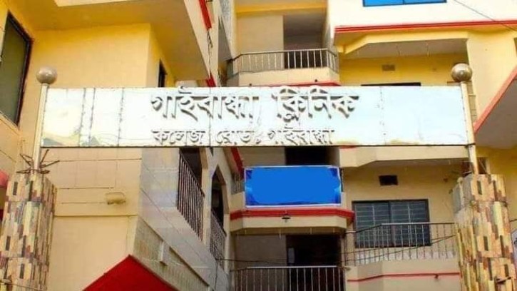 গাইবান্ধায় পেটে গজ রেখেই সেলাই, তদন্ত কমিটি গঠন