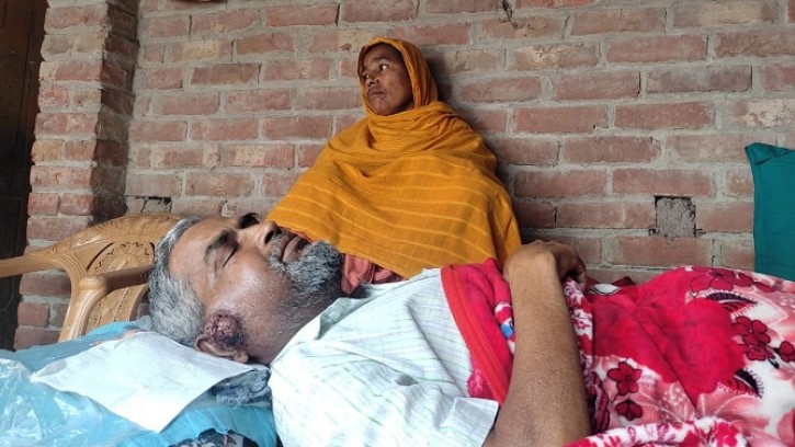 শিবগঞ্জে ক্যান্সারে আক্রান্ত স্বামীকে বাঁচাতে স্ত্রীর আকুতি