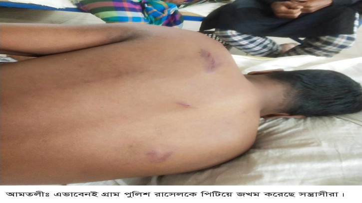 গ্রাম পুলিশ সহ অপর দুই ভাইকে পিটিয়ে জখম