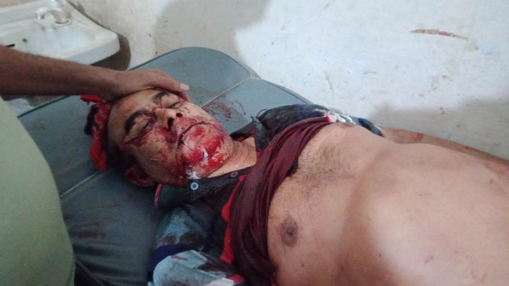 শার্শায় মোটরসাইকেলের ধাক্কায় এ্যাডভোকেট নিহত