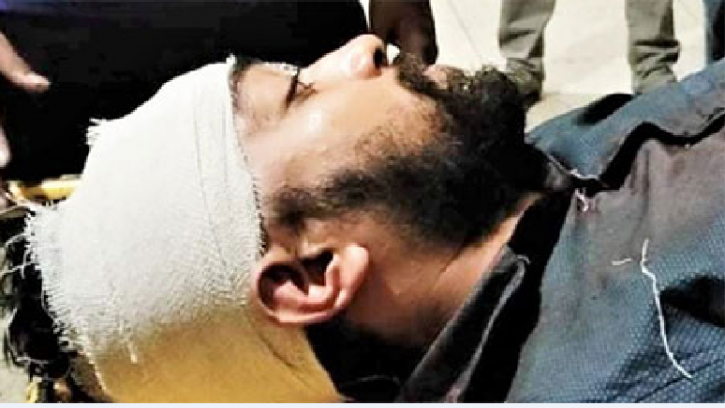 ছিনতাইকারী ধরতে গিয়ে ছুরিকাহত ঢাবি শিক্ষার্থী