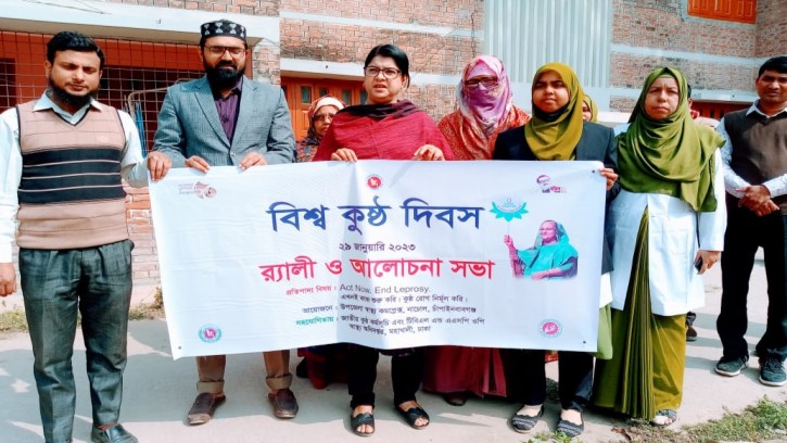 নাচোলে বিশ্ব কুষ্ঠ দিবস পালিত