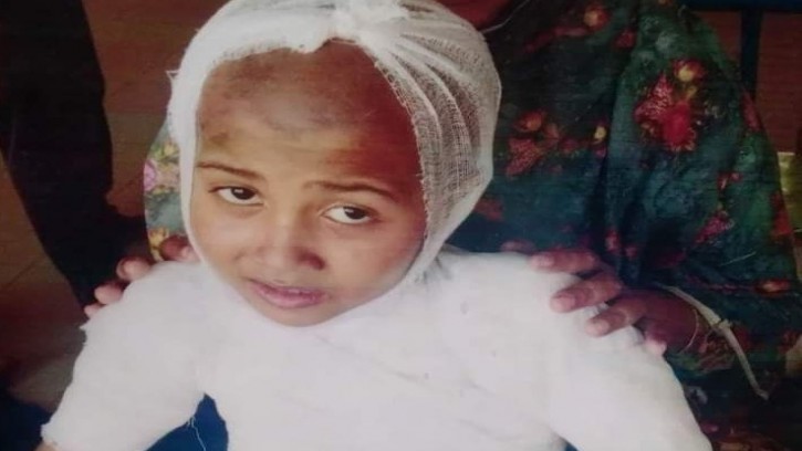  আগুন পোহাতে গিয়ে অগ্নিদগ্ধ মরিয়ম, চিকিৎসা সহায়তা কামনা